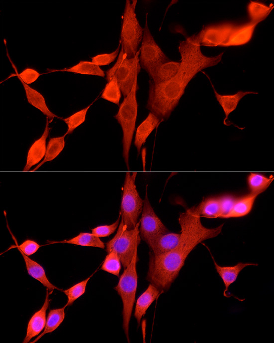 Immunofluorescence analysis of NIH/3T3 cells using FPR2 Polyclonal Antibody at dilution of 1:50 (40x lens). Blue: DAPI for nuclear staining.