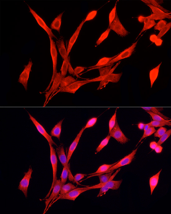 Immunofluorescence analysis of PC-12 cells using FPR2 Polyclonal Antibody at dilution of 1:50 (40x lens). Blue: DAPI for nuclear staining.