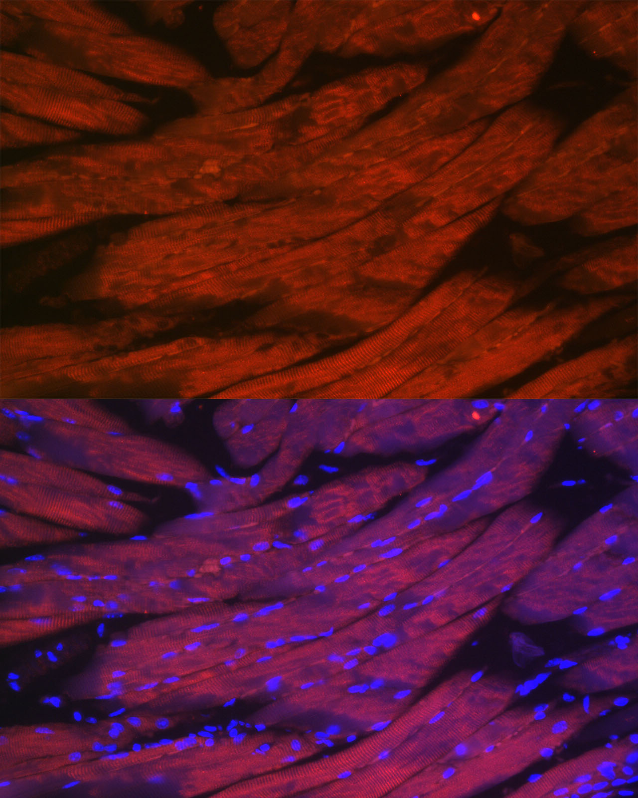 Immunofluorescence analysis of mouse skeletal muscle cells using CACNA1S Polyclonal Antibody atdilution of 1:50 (40x lens). Blue: DAPI for nuclear staining.