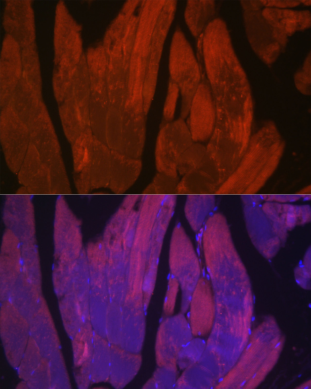 Immunofluorescence analysis of rat skeletal muscle cells using CACNA1S Polyclonal Antibody at dilution of 1:50 (40x lens). Blue: DAPI for nuclear staining.