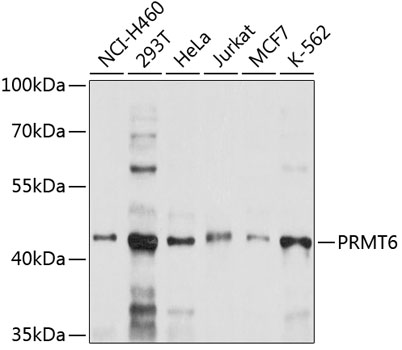 Western blot analysis of extracts of various cell lines using PRMT6 Polyclonal Antibody at 1:1000 dilution.