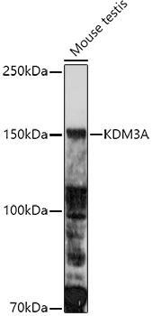 Western blot analysis of extracts of Mouse testis using KDM3A Polyclonal Antibody at 1:1000 dilution.