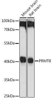 Western blot analysis of extracts of various cell lines using PRMT8 Polyclonal Antibody at 1:1000 dilution.