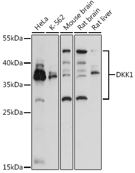 Western blot analysis of extracts of various cell lines using DKK1 Polyclonal Antibody at 1:3000 dilution.