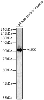 Western blot analysis of Mouse skeletal muscle using MUSK Polyclonal Antibody at 1:500 dilution.