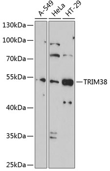 Western blot analysis of extracts of various cell lines using TRIM38 Polyclonal Antibody at 1:1000 dilution.