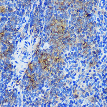 Immunohistochemistry of paraffin-embedded Mouse spleen using STAT4 Polyclonal Antibody at dilution of 1:100 (40x lens).Perform microwave antigen retrieval with 10 mM PBS buffer pH 7.2 before commencing with IHC staining protocol.