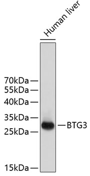 Western blot analysis of extracts of human liver using BTG3 Polyclonal Antibody