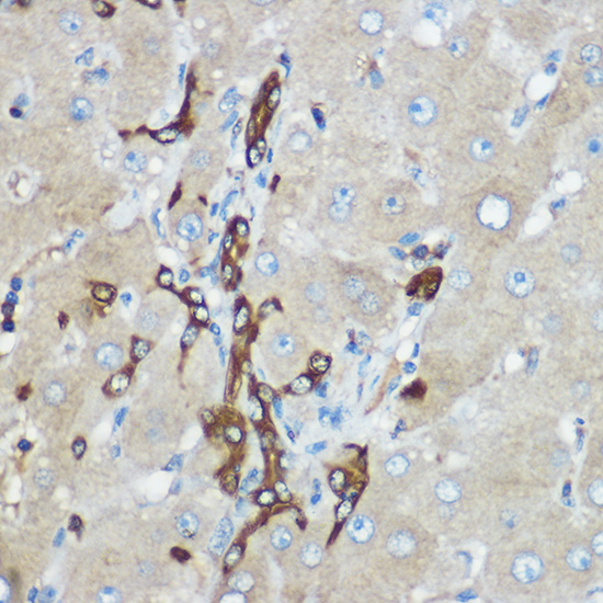 Immunohistochemistry of paraffin-embedded human liver using [KO Validated] Calpain 2 Polyclonal Antibody at dilution of 1:100 (40x lens).Perform high pressure antigen retrieval with 10 mM citrate buffer pH 6.0 before commencing with IHC staining protocol.