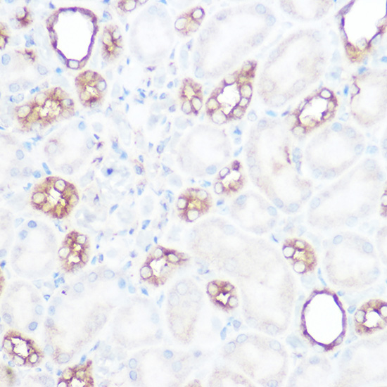 Immunohistochemistry of paraffin-embedded mouse kidney using [KO Validated] Calpain 2 Polyclonal Antibody at dilution of 1:100 (40x lens).Perform high pressure antigen retrieval with 10 mM citrate buffer pH 6.0 before commencing with IHC staining protocol