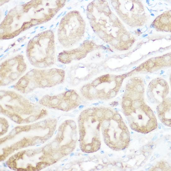 Immunohistochemistry of paraffin-embedded rat kidney using [KO Validated] Calpain 2 Polyclonal Antibody at dilution of 1:100 (40x lens).Perform high pressure antigen retrieval with 10 mM citrate buffer pH 6.0 before commencing with IHC staining protocol.