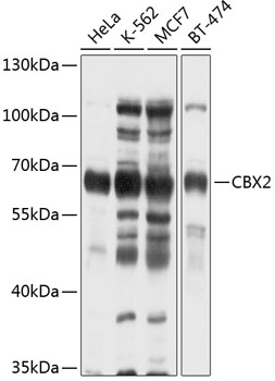 Western blot analysis of extracts of various cell lines using CBX2 Polyclonal Antibody at 1:1000 dilution.