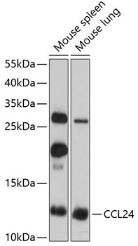 Western blot analysis of extracts of various cell lines using CCL24 Polyclonal Antibody at 1:3000 dilution.