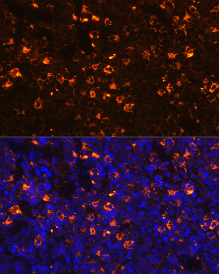 Immunofluorescence analysis of mouse spleen using CLEC4D Polyclonal Antibody at dilution of 1:100 (40x lens). Blue: DAPI for nuclear staining.