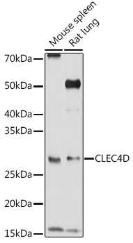 Western blot analysis of extracts of various cell lines using CLEC4D Polyclonal Antibody at1:1000 dilution.