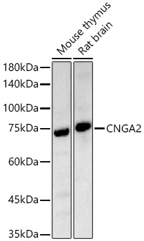 Western blot analysis of various lysates using CNGA2 Polyclonal Antibody at 1:400 dilution.