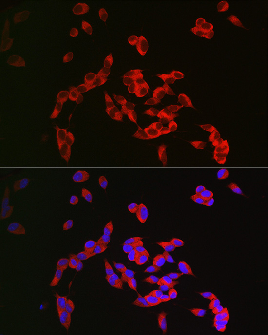 Immunofluorescence analysis of SH-SY5Y cells using CRMP1 Polyclonal Antibody at dilution of 1:300 (40x lens). Blue: DAPI for nuclear staining.