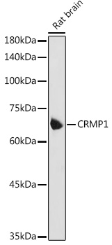 Western blot analysis of extracts of Rat brain using CRMP1 Polyclonal Antibody at 1:1000 dilution.