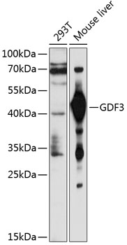 Western blot analysis of extracts of various cell lines using GDF3 Polyclonal Antibody at 1:1000 dilution.