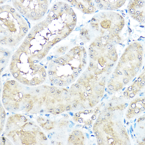 Immunohistochemistry of paraffin-embedded rat kidney using VCP Polyclonal Antibody at dilution of 1:100 (40x lens).Perform high pressure antigen retrieval with 10 mM citrate buffer pH 6.0 before commencing with IHC staining protocol.