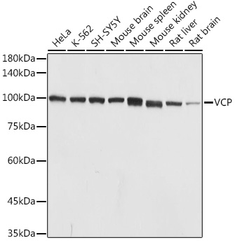 Western blot analysis of extracts of various cell lines using VCP Polyclonal Antibody at 1:1000 dilution.