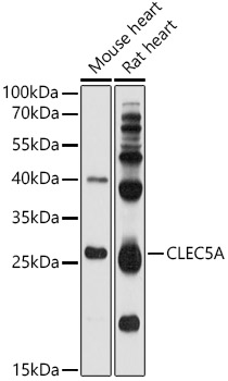 Western blot analysis of extracts of various cell lines using CLEC5A Polyclonal Antibody at 1:1000 dilution.