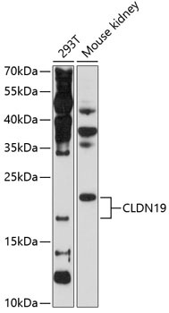 Western blot analysis of extracts of various cell lines using CLDN19 Polyclonal Antibody at 1:1000 dilution.