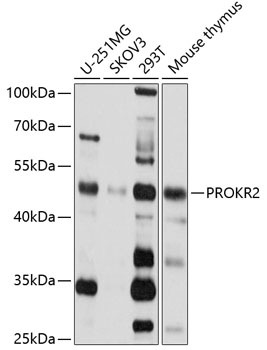 Western blot analysis of extracts of various cell lines using PROKR2 Polyclonal Antibody at 1:1000 dilution.