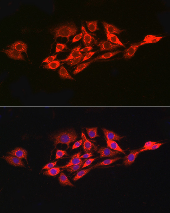 Immunofluorescence analysis of PC-12 cells using CD215/IL-15R alpha Polyclonal Antibody at dilution of 1:100 (40x lens). Blue: DAPI for nuclear staining.