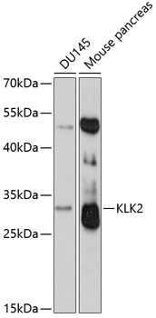 Western blot analysis of extracts of various cell lines using KLK2 Polyclonal Antibody at 1:3000 dilution.