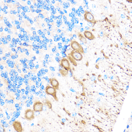 Immunohistochemistry of paraffin-embedded Mouse brain using MMP17 Polyclonal Antibody at dilution of 1:100 (40x lens).Perform microwave antigen retrieval with 10 mM PBS buffer pH 7.2 before commencing with IHC staining protocol.