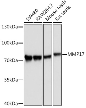 Western blot analysis of extracts of various cell lines using MMP17 Polyclonal Antibody at1:1000 dilution.