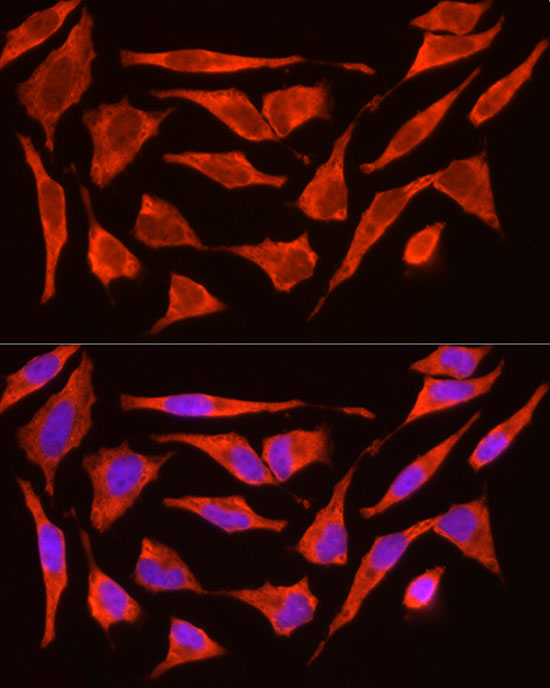 Immunofluorescence analysis of HeLa cells using POMC Polyclonal Antibody atdilution of 1:200 (40x lens). Blue: DAPI for nuclear staining.