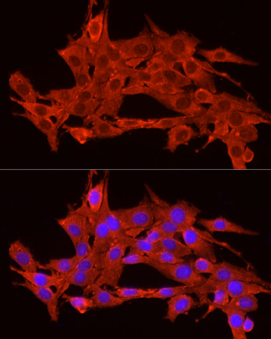 Immunofluorescence analysis of PC-12 cells using POMC Polyclonal Antibody at dilution of 1:200 (40x lens). Blue: DAPI for nuclear staining.