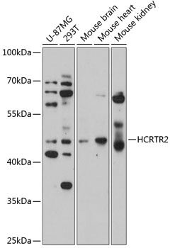 Western blot analysis of extracts of various cell lines using HCRTR2 Polyclonal Antibody at 1:1000 dilution.