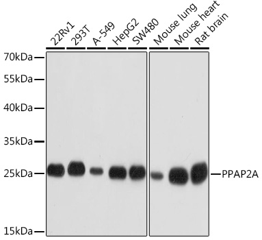 Western blot analysis of extracts of various cell lines using PPAP2A Polyclonal Antibody at1:1000 dilution.