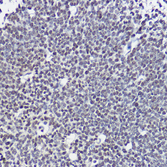 Immunohistochemistry of paraffin-embedded mouse embryos using SOX1 Polyclonal Antibody at dilution of 1:20 (40x lens).Perform high pressure antigen retrieval with 10 mM citrate buffer pH 6.0 before commencing with IHC staining protocol.