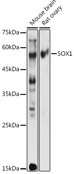 Western blot analysis of extracts of various cell lines using SOX1 Polyclonal Antibody at 1:1000 dilution.