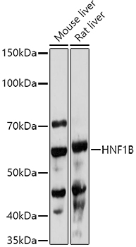 Western blot analysis of extracts of various cell lines using HNF1B Polyclonal Antibody at 1:1000 dilution.