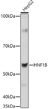 Western blot analysis of extracts of HepG2 cells using HNF1B Polyclonal Antibody at 1:1000 dilution.