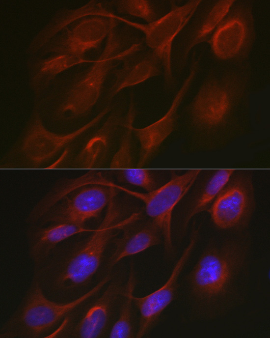 Immunofluorescence analysis of U2OS cells using TRAF7 Polyclonal Antibody at dilution of 1:50. Blue: DAPI for nuclear staining.