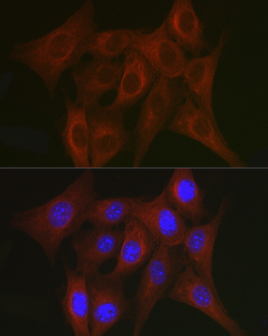 Immunofluorescence analysis of NIH/3T3 cells using TRAF7 Polyclonal Antibody at dilution of 1:50. Blue: DAPI for nuclear staining.