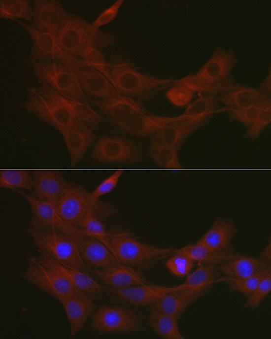 Immunofluorescence analysis of PC-12 cells using TRAF7 Polyclonal Antibody at dilution of 1:50. Blue: DAPI for nuclear staining.