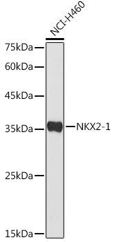 Western blot analysis of extracts of NCI-H460 cells using NKX2-1 Polyclonal Antibody at 1:500 dilution.