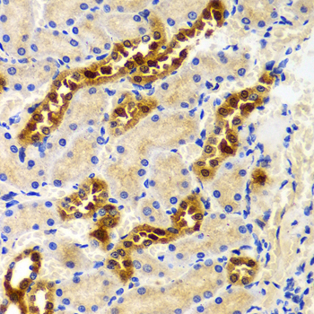 Immunohistochemistry of paraffin-embedded rat kidney using PIWIL4 Polyclonal Antibody at dilution of 1:100 (40x lens).Perform microwave antigen retrieval with 10 mM PBS buffer pH 7.2 before commencing with IHC staining protocol.