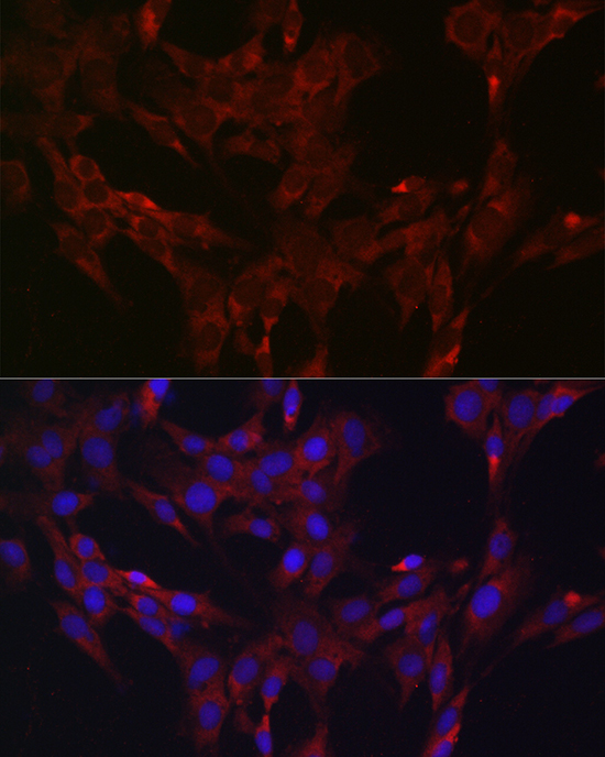 Immunofluorescence analysis of C6 cells using DUSP6 Polyclonal Antibody at dilution of 1:100 (40x lens). Blue: DAPI for nuclear staining.