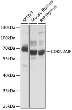 Western blot analysis of extracts of various cell lines using CDKN2AIP Polyclonal Antibody at 1:1000 dilution.