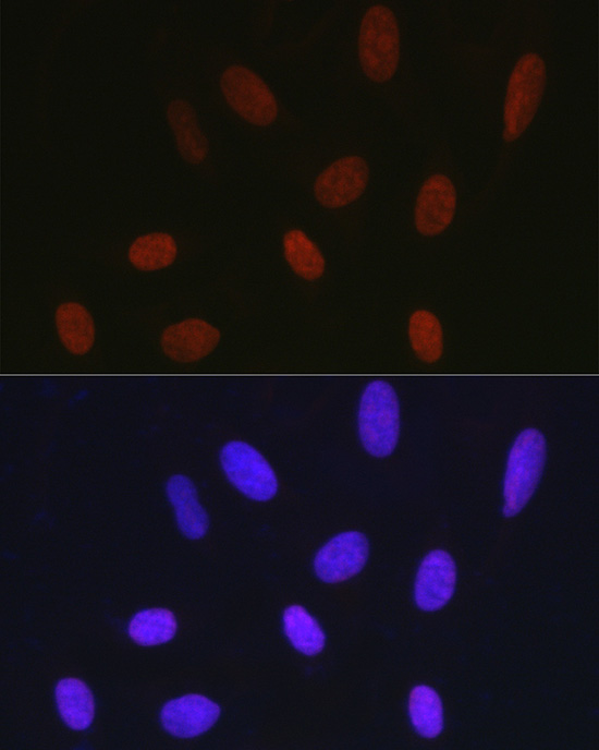 Immunofluorescence analysis of U2OS cells using HIST1H1C Polyclonal Antibody at dilution of 1:200 (40x lens). Blue: DAPI for nuclear staining.