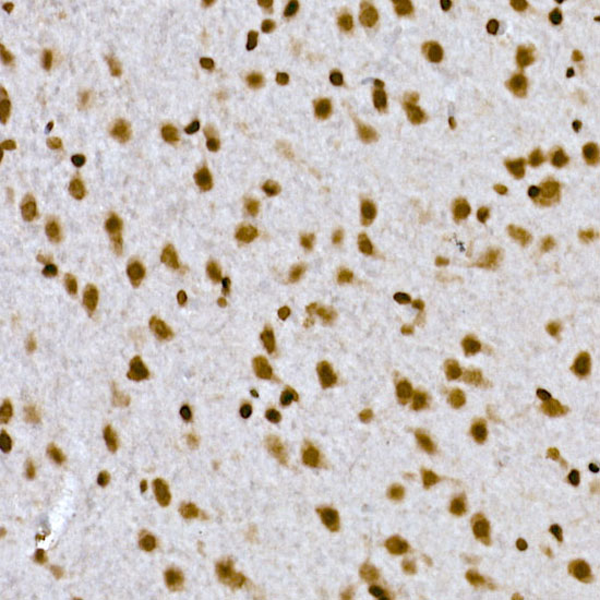 Immunohistochemistry of paraffin-embedded rat brain using HIST1H1C Polyclonal Antibody at dilution of 1:200 (40x lens).Perform high pressure antigen retrieval with 10 mM citrate buffer pH 6.0 before commencing with IHC staining protocol.