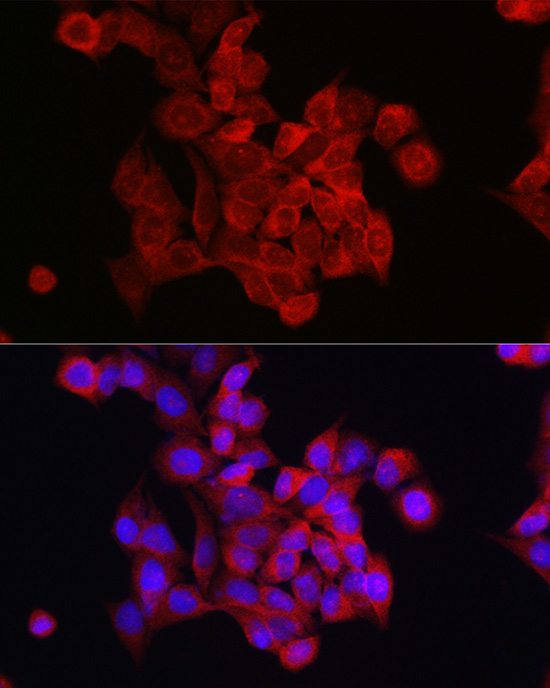 Immunofluorescence analysis of HeLa cells using FOXO4 Polyclonal Antibody at dilution of 1:100 (40x lens). Blue: DAPI for nuclear staining.